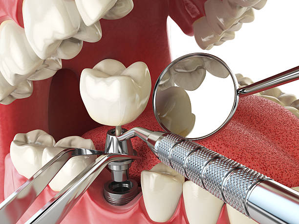Best Emergency Treatment for Oral Infections in Cottage Grove, OR